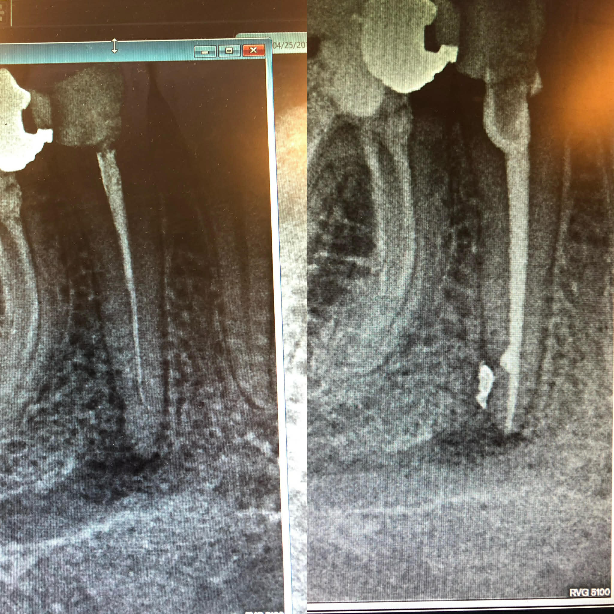 Before & after